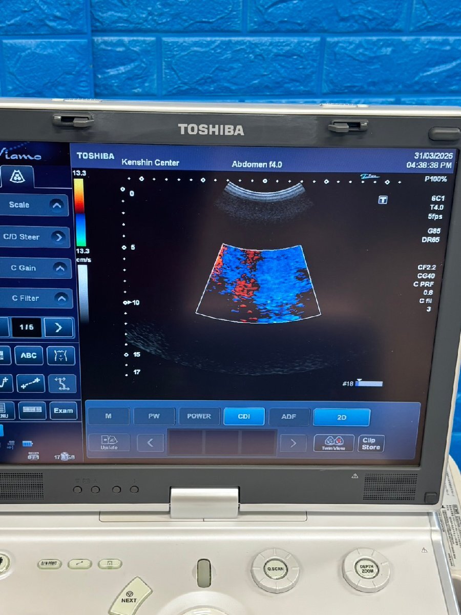 Toshiba Viamo Ultrasound Diagnostic System [s1226499175]