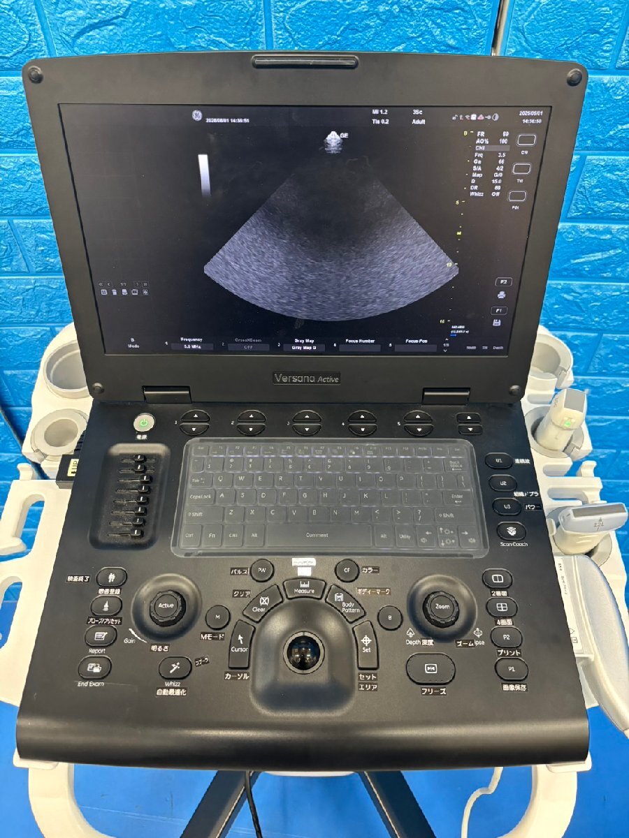 GE Versana Active Ultrasound Diagnostic System [e1232183133]