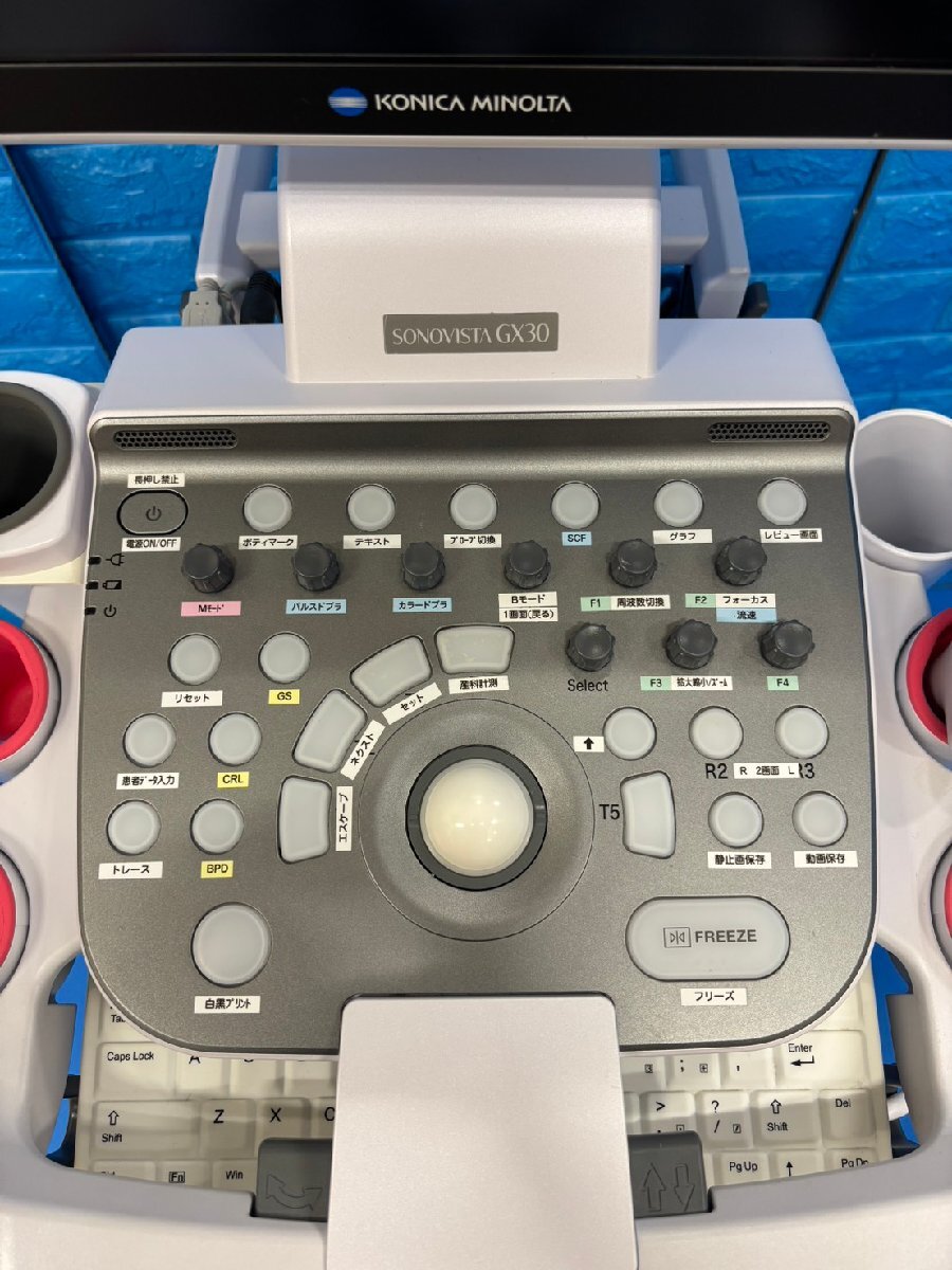 Konica Minolta SONOVISTA GX30 Ultrasound Diagnostic System [l1236124596]