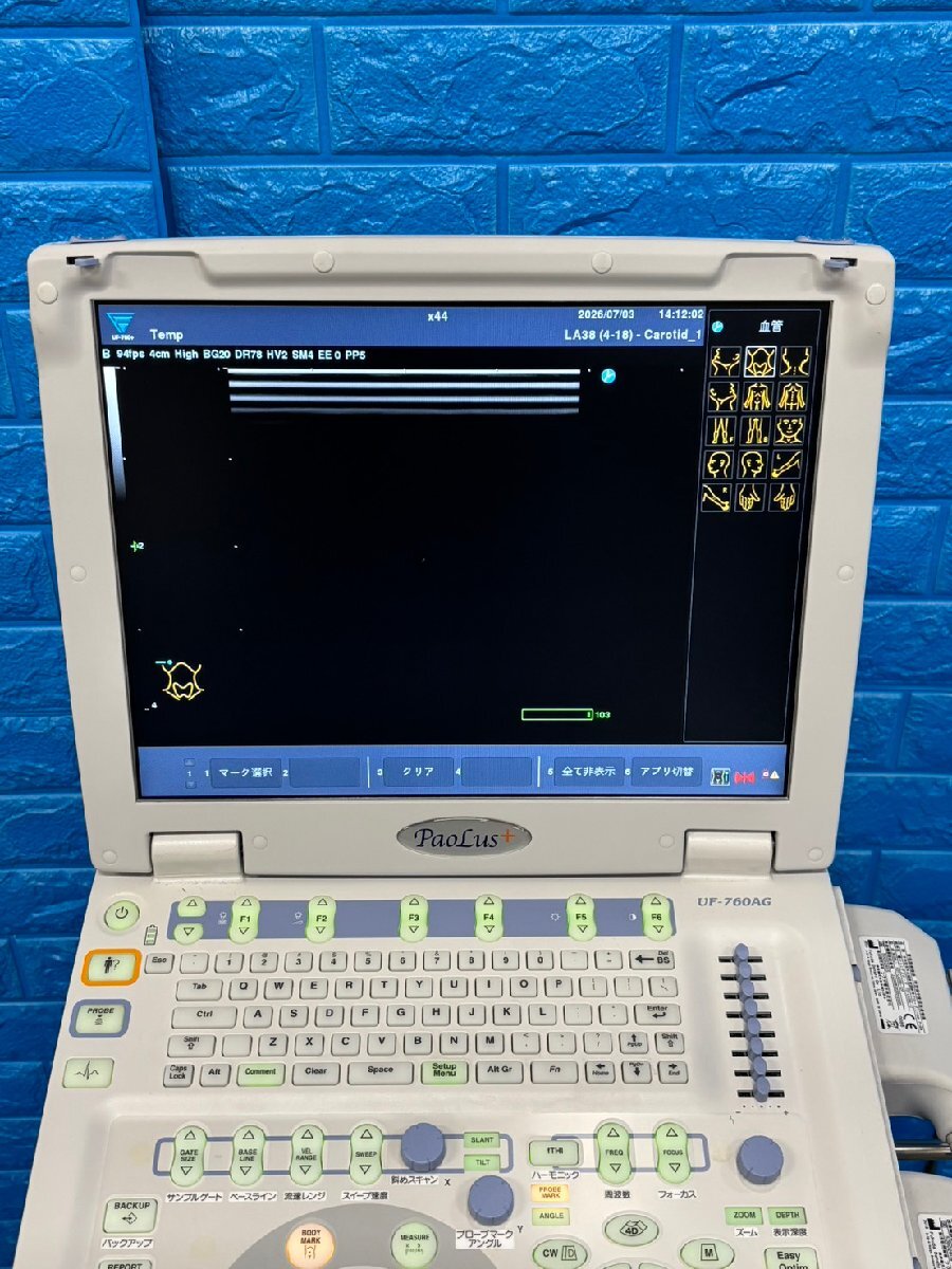 Fukuda Denshi UF-760AG+ Ultrasound Diagnostic System [p1236359183]
