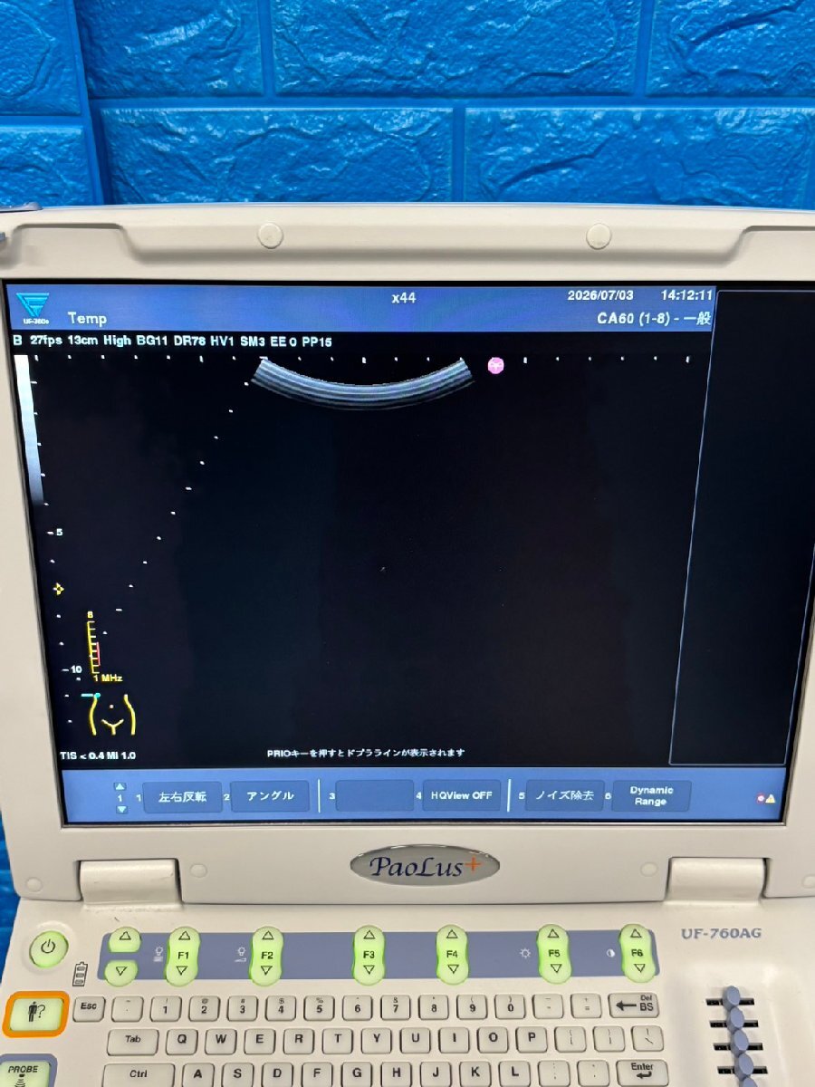 Fukuda Denshi UF-760AG+ Ultrasound Diagnostic System [p1236359183]