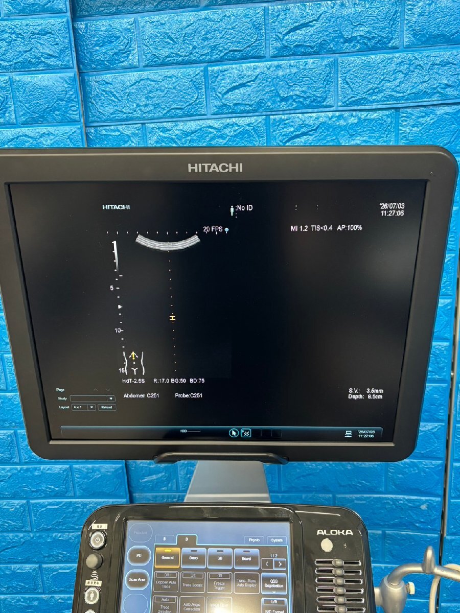 Hitachi Aloka ARIETTA S60 Ultrasound Diagnostic System [u1236887615]