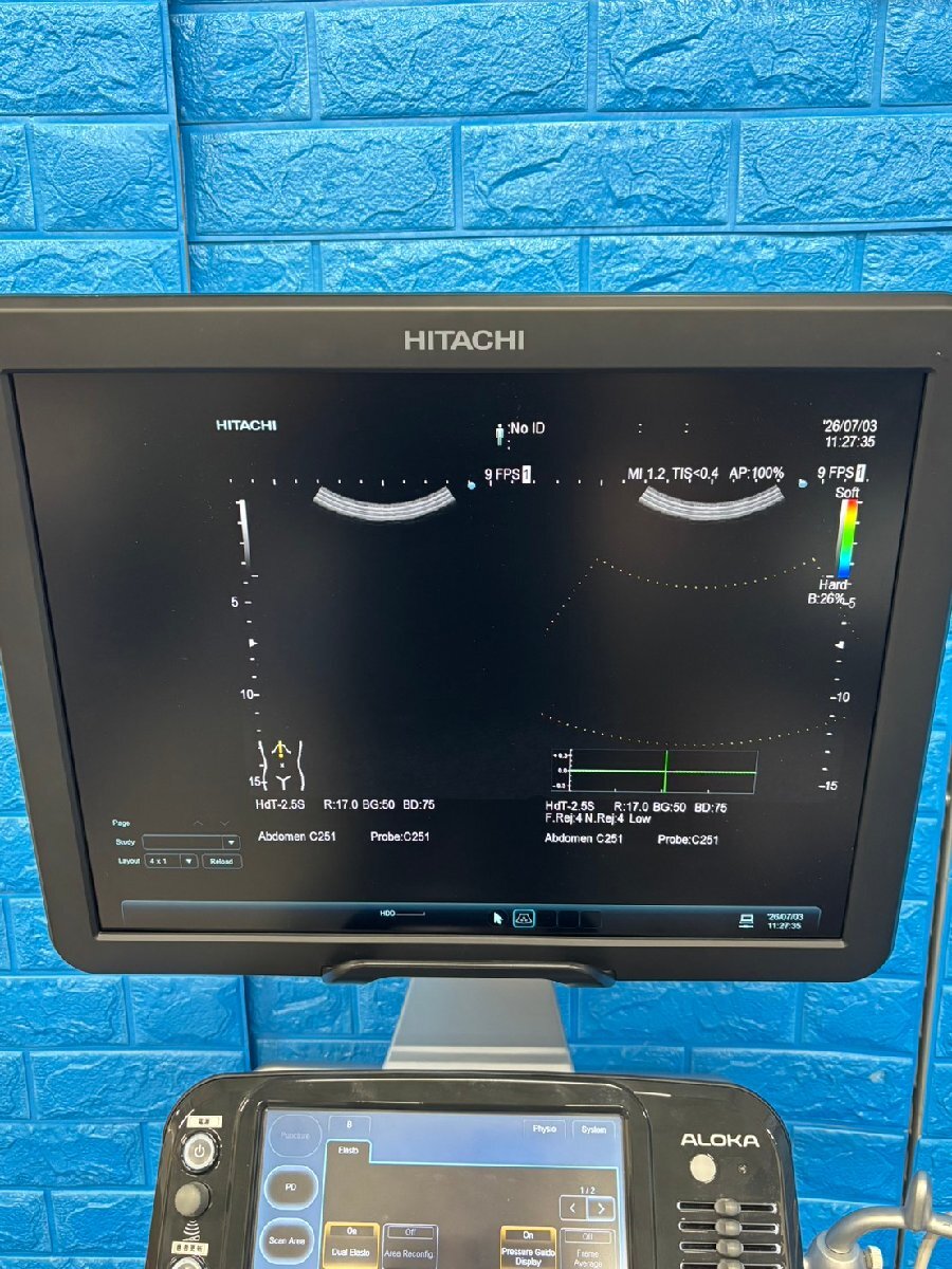 Hitachi Aloka ARIETTA S60 Ultrasound Diagnostic System [u1236887615]