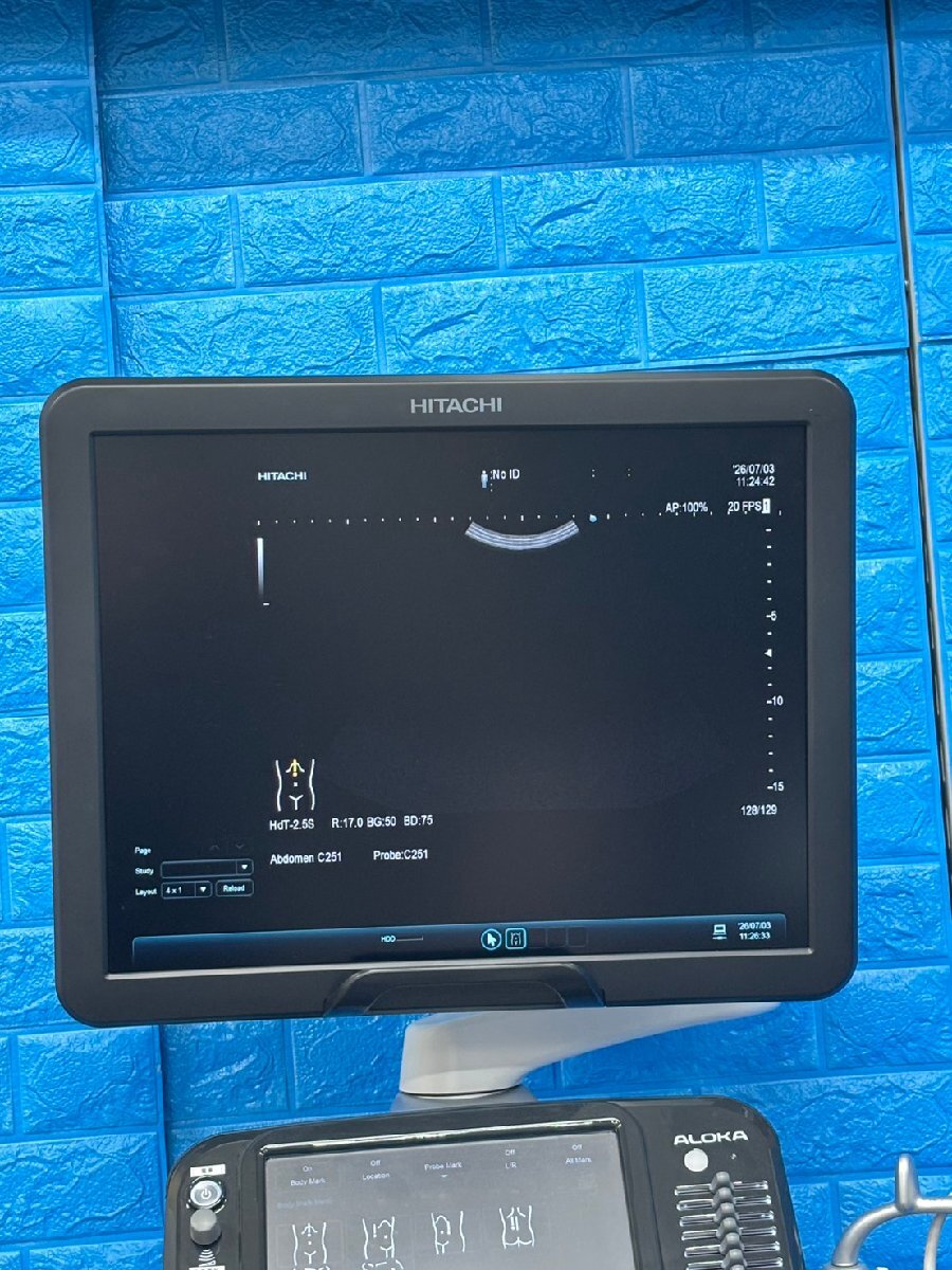 Hitachi Aloka ARIETTA S60 Ultrasound Diagnostic System [u1236887615]