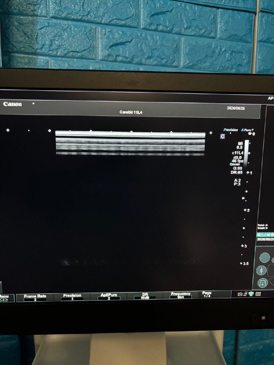 Canon Aplio go Ultrasound Diagnostic System [k1242271172]
