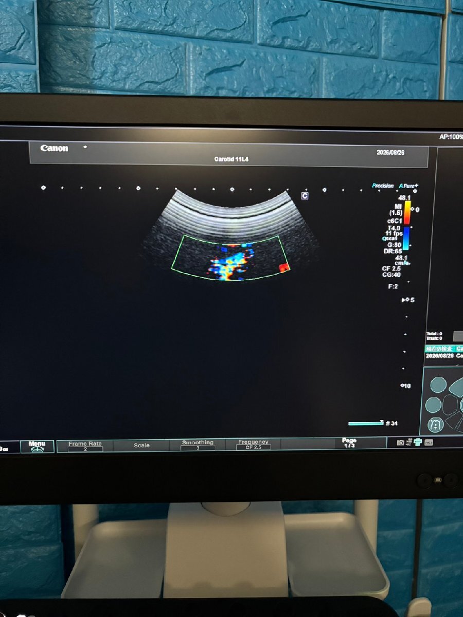 Canon Aplio go Ultrasound Diagnostic System [k1242271172]