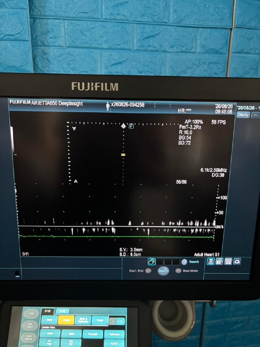 FUJIFILM ARIETTA 650 DeepInsight Ultrasound Diagnostic System [k1242268988]