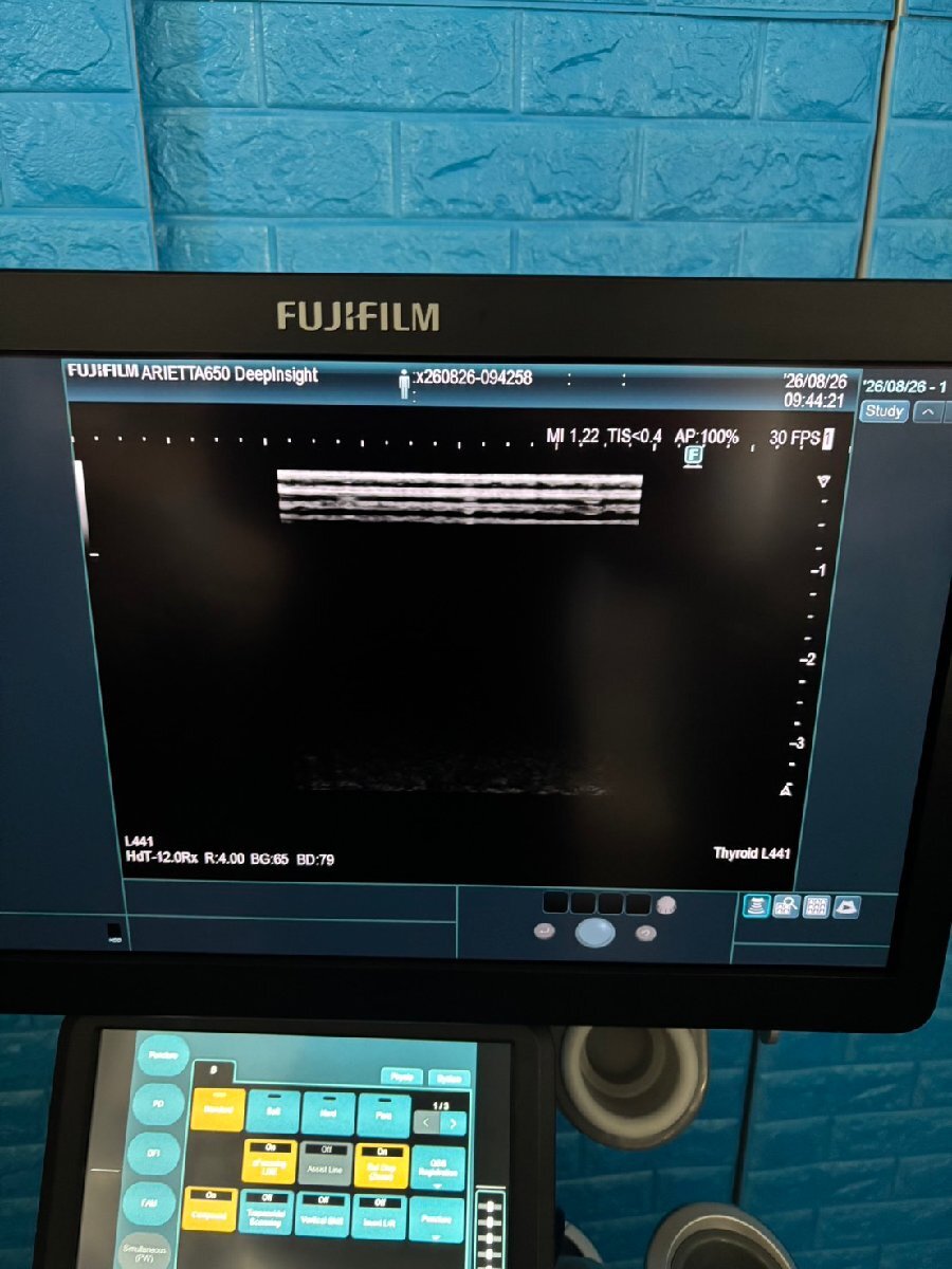 FUJIFILM ARIETTA 650 DeepInsight Ultrasound Diagnostic System [k1242268988]