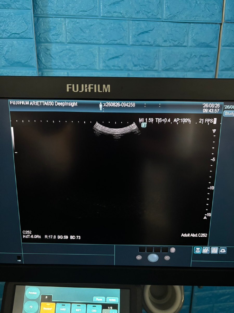 FUJIFILM ARIETTA 650 DeepInsight Ultrasound Diagnostic System [k1242268988]