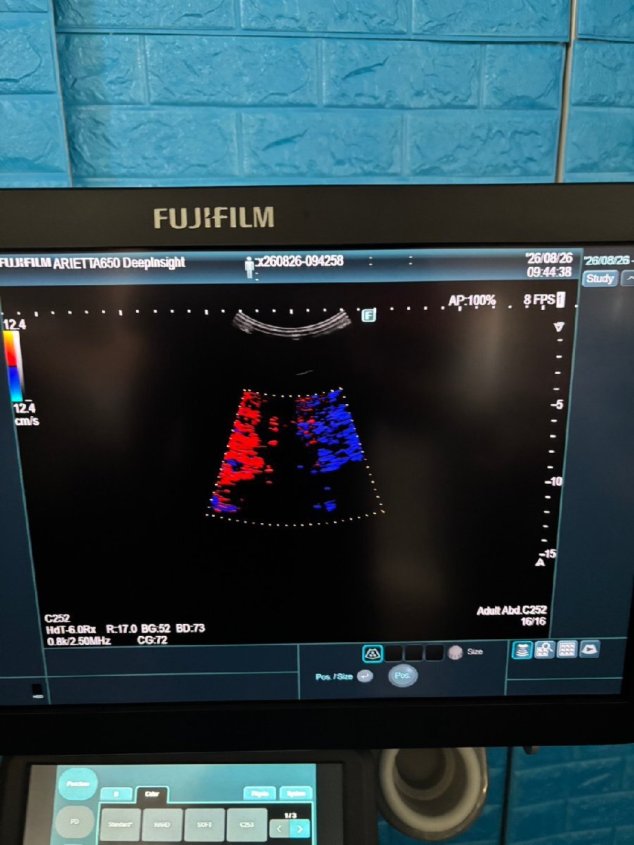 FUJIFILM ARIETTA 650 DeepInsight Ultrasound Diagnostic System [k1242268988]