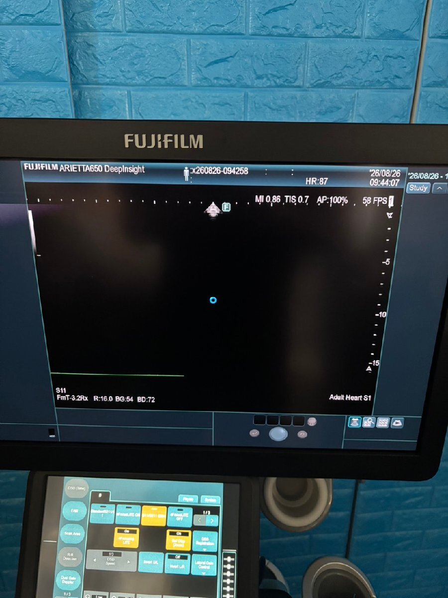 FUJIFILM ARIETTA 650 DeepInsight Ultrasound Diagnostic System [k1242268988]