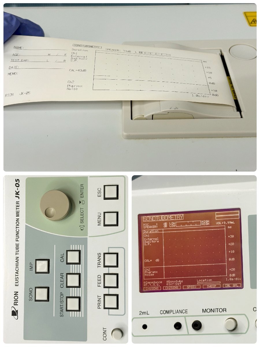 Rion JK-05 Eustachian Tube Function Testing Device [w1242513404]