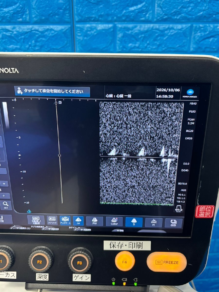 Konica Minolta SONIMAGE MX1 Ultrasound Imaging System [o1247295290]