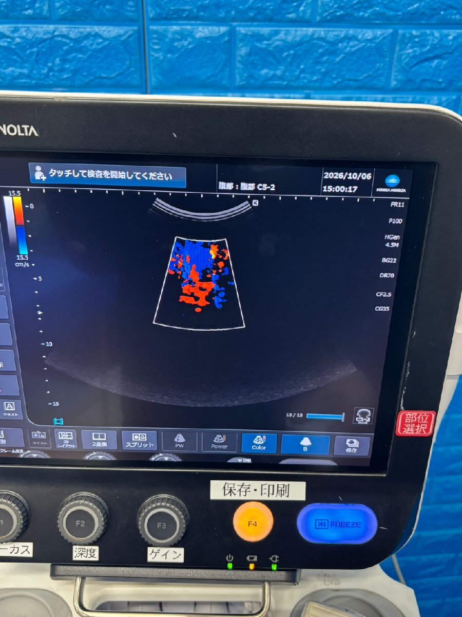 Konica Minolta SONIMAGE MX1 Ultrasound Imaging System [o1247295290]