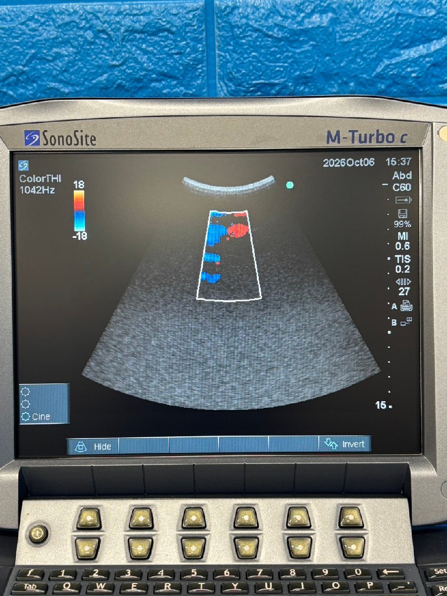 FUJIFILM SonoSite M-Turbo c Ultrasound Diagnostic System [f1247280345]