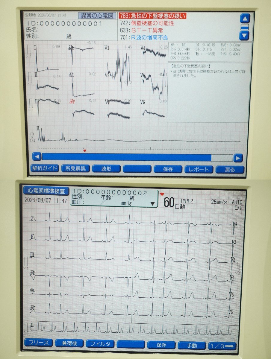 Fukuda Denshi FCP-7541 Multi-Function Electrocardiograph Parts Only (for parts or not working) [r1250019906]