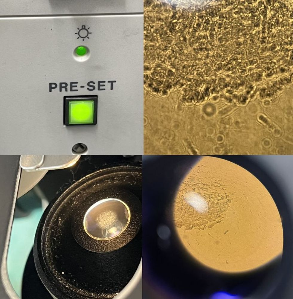 Olympus BX41TF Biological Microscope with Plan 100x UPlanFl 10x 20x Objective Lenses [p1236140768]